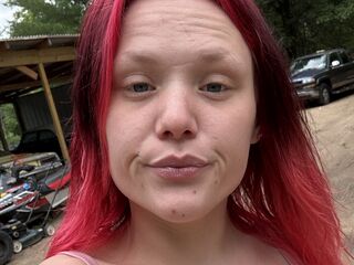 live teaser webcam CherryFynee